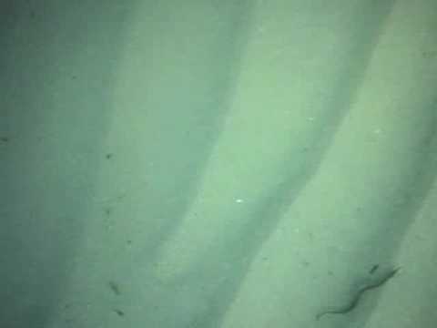 Lanalisi su helminths in Vladivostok Medicine da lyambliya al bambino
