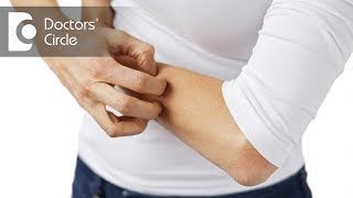How to manage continuous itching over the body? - Dr. Rashmi Ravindra