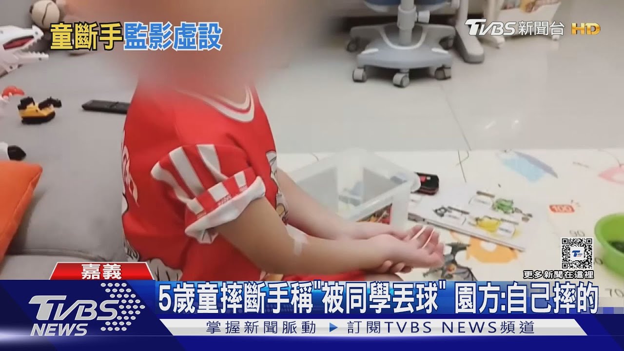 5歲童上幼兒園摔斷手!監視器恰巧壞了 家長質疑隱瞞