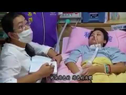 Hopping skema tali pelangsing Hak untuk mengambil Reduxine