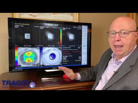 Using the iTrace Corneal MTF as a screening tool for MFIOL patients