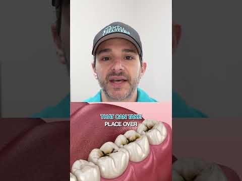 Why the 6-Year Molar Matters 👇