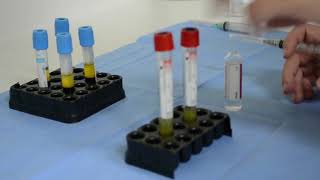 Plasmagel cuarta generación SMI Equipments