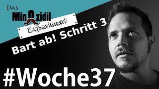 Das Minoxidil Experiment #Woche37 Der Bart kommt ab Stufe3 + Überraschung