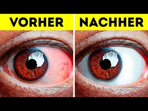 10+ Simple Übungen, die müde Augen munter machen
