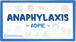 Anaphylaxis: Nursing Process (ADPIE)