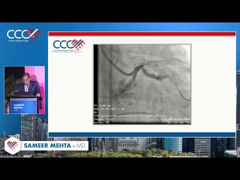 Sameer Mehta, MD   Case #5  My Worst STEMI Complication
