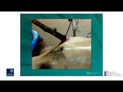 Oxford University surgical lectures: Primary Trauma Care