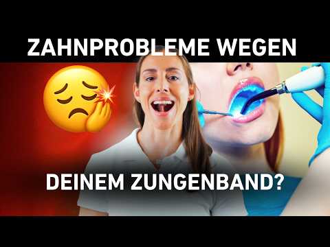 Zungenband-Test: Darum leidet dein Kiefer & Nacken! 😱