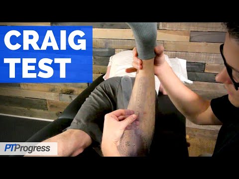 Craig Test | Hip Anteversion / Retroversion