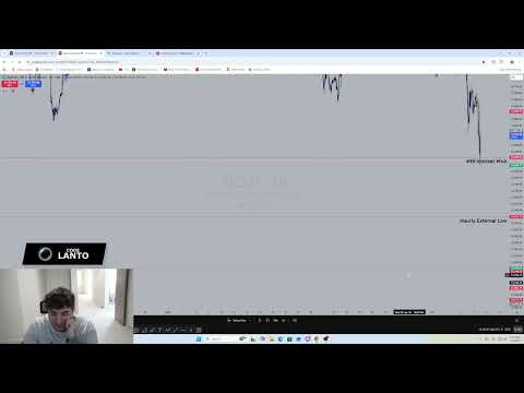 How I Made +$80,183.88 Day Trading LIVE in 30 Minutes!