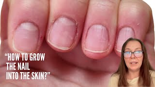 "How to grow the nail into the skin?"