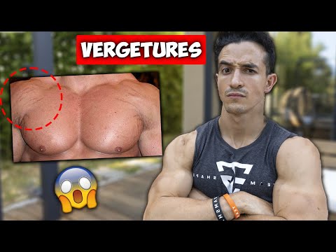 COUP DE GUEULE : LES VERGETURES !