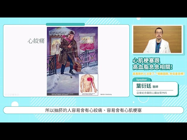 認識急性心肌梗塞