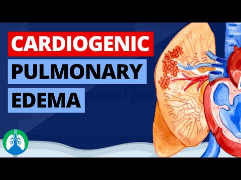Cardiogenic Pulmonary Edema (Medical Definition) | Quick Explainer Video