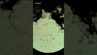 Download lagu Chlorine vs Germs Under Microscope mp3