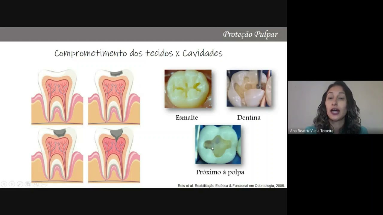 Aula Proteção Pulpar e Hidróxido de Cálcio - Parte 1