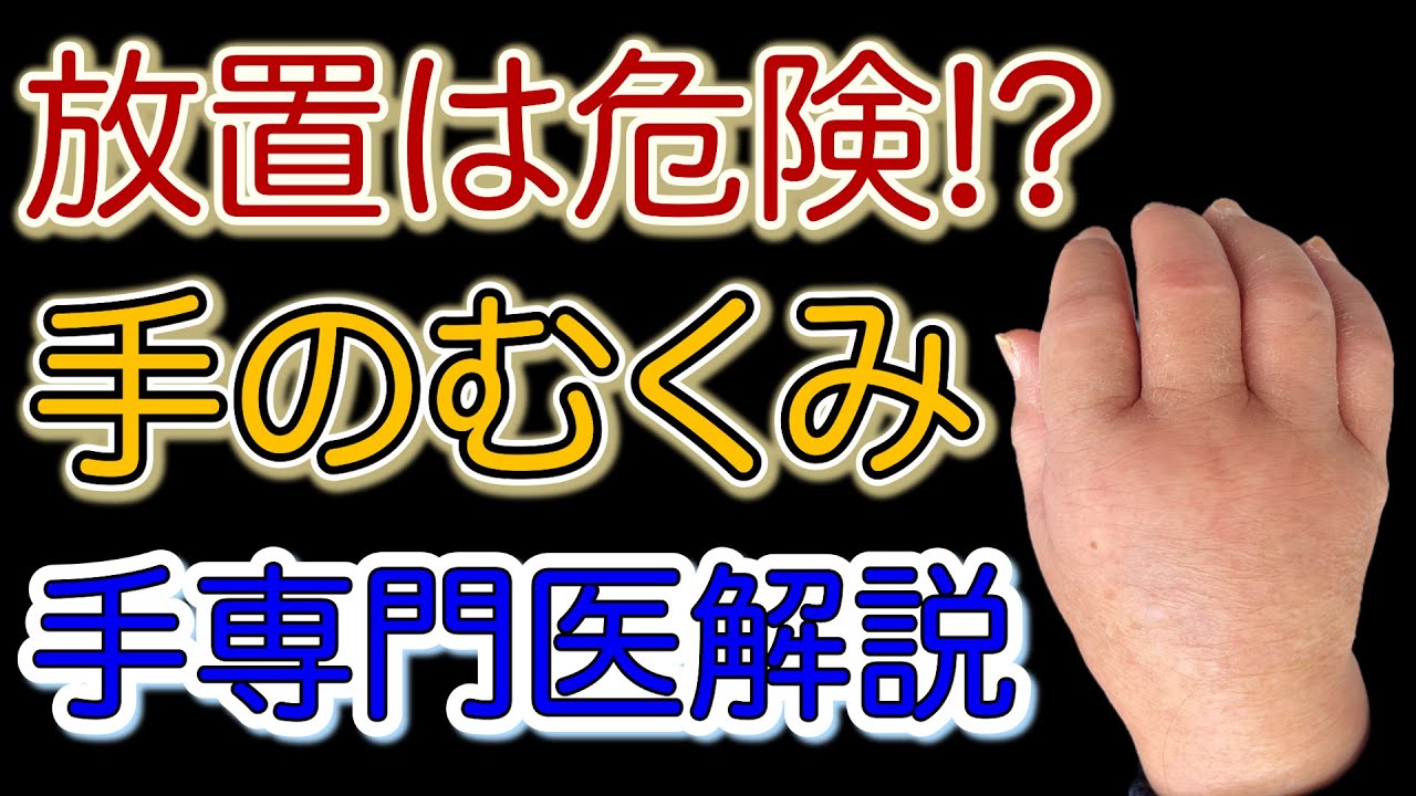 【手専門医解説】手のむくみが危険な理由とその治療法