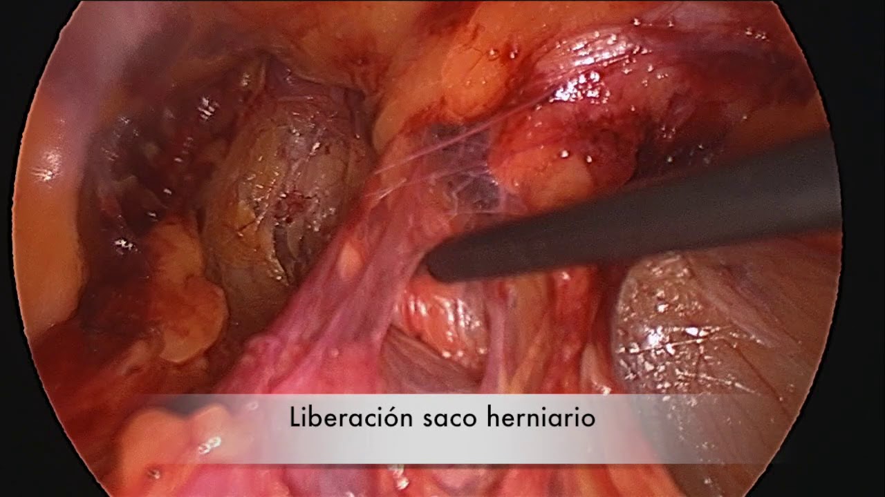 Juan Pablo Marin Calahorrano-2