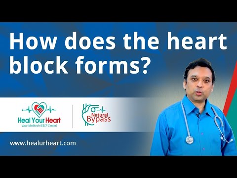 How does the heart block forms?