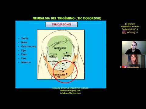 Neuralgia del Trigémino