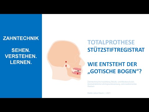 Totalprothese Stützstiftregistrat nach Gerber