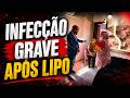 ABSURDO! Idosa sofre INFECÇÃO GRAVE após clínica fazer procedimento estético!