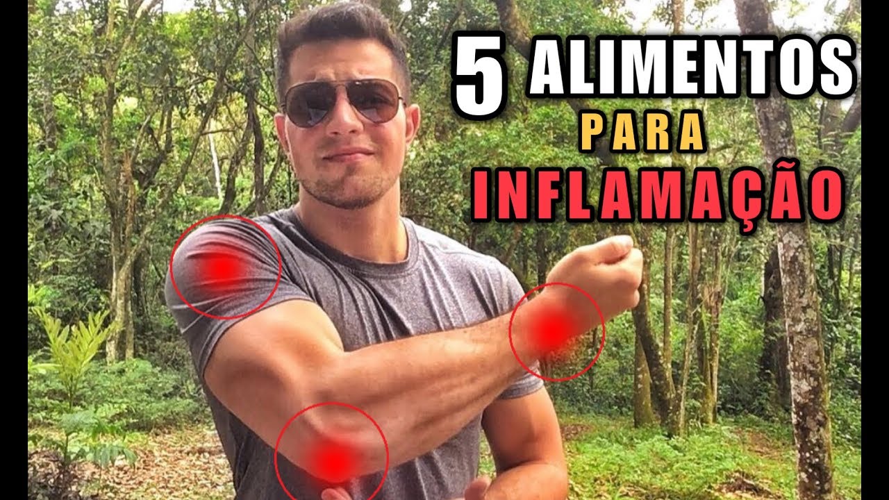 5 Alimentos Naturais Anti-Inflamatórios