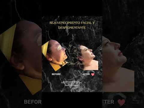 Edgar Octavio Rosales Diaz-90
