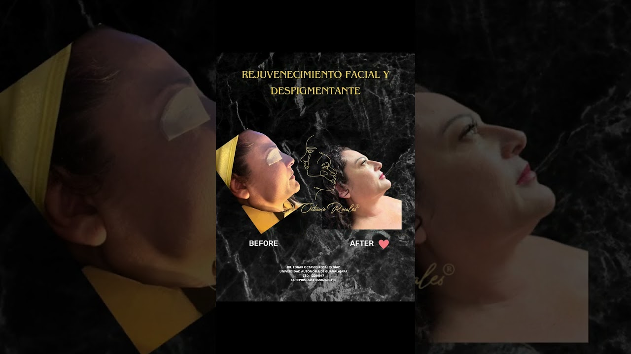 Edgar Octavio Rosales Diaz-90