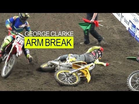George Clarke BREAKS ARM – Pro Lites Race 2 | AX Manchester 2017
