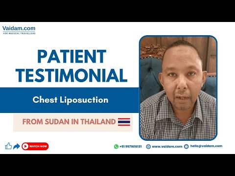 Patient From Sudan Successfully Underwent Chest Liposuction in Thailand
