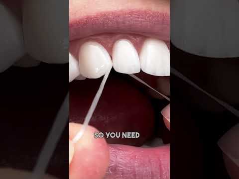 Bleeding Gums? Why You Should Keep Flossing