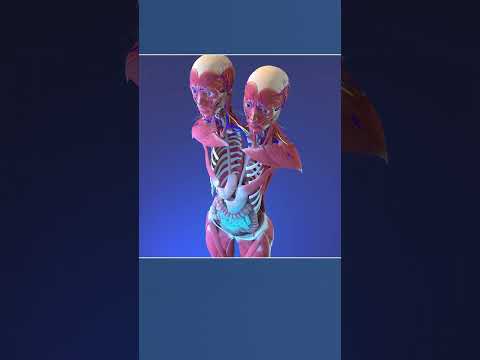 Two Heads, One Body: Anatomy of Conjoined Twins