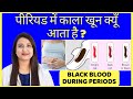 पीरियड में काला खून क्यूँ आता है ? BLACK FLOW DURING PERIODS