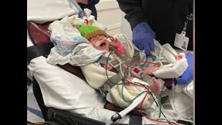Baby With RSV Suffers Severe Complications