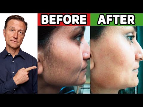 The 2 Minute Sore Throat Solution