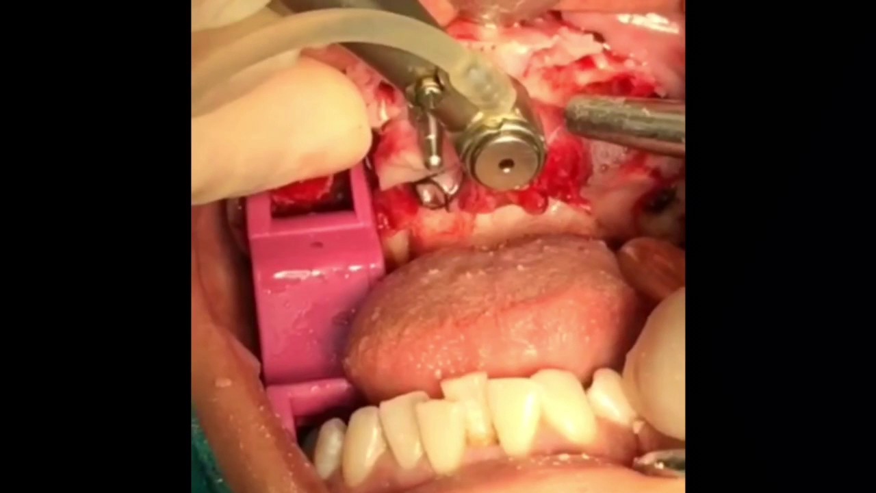 Tolga Gülçiçek-47