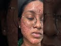 Best Face Beauty Cream Order Now 9633062546 Whatsapp Trending Youtube Repost Instareels Tamil