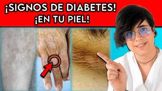 10 SEÑALES de la DIABETES que se manifiestan en tu PIEL || ¡Cual es la PEOR?