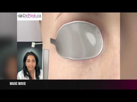 Lumecca IPL Treatment for Dry Eyes