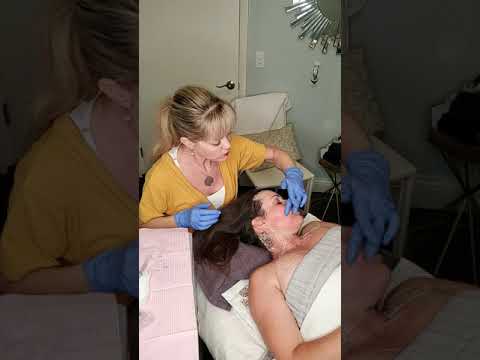 Neck Rejuvenation | Stem Cell Microneedling | Vampire Facial | Sarasota Rejuvenate 528 Medical Spa