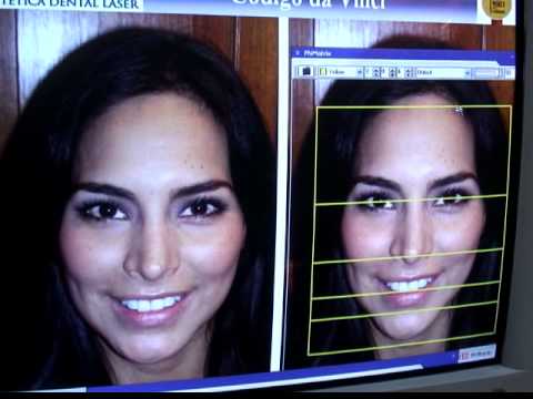 Procedimiento Vivesalud