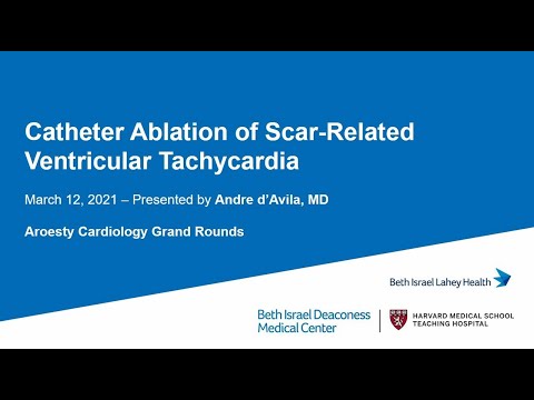 Catheter Ablation of Scar-Related Ventricular Tachycardia by Andre d'Avila, MD (BIDMC)
