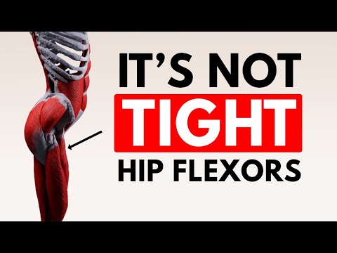 The Shocking Truth About Fixing Anterior Pelvic Tilt