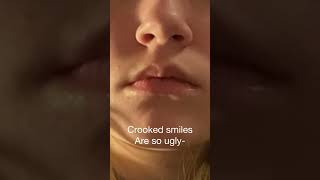 Crooked smiles are so ugly 🙄 (btw your beautiful/handsome)