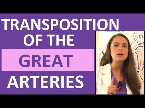 Transposition of the Great Arteries (Vessels) | Congenital Heart Defects Nursing NCLEX Pediatrics