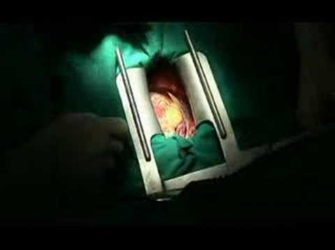 Dolore nella parte bassa della schiena e appendici durante la gravidanza Massaggio articolazione metatarso-falangea