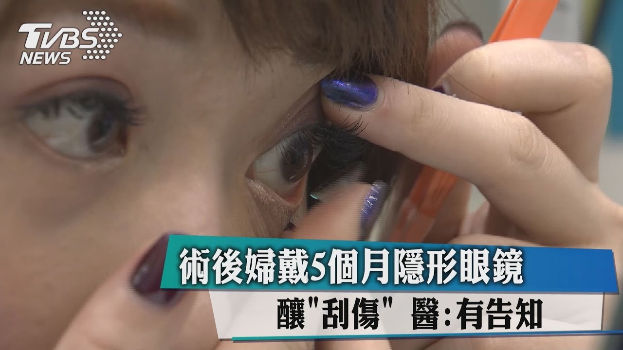 術後婦戴5個月隱形眼鏡釀「刮傷」 醫:有告知