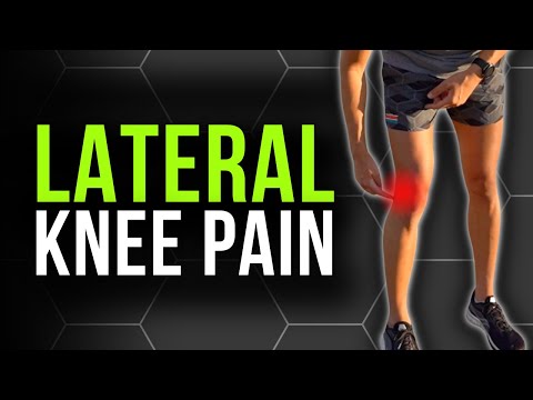 Lateral Knee Pain When Running | How to Fix IT Band Syndrome